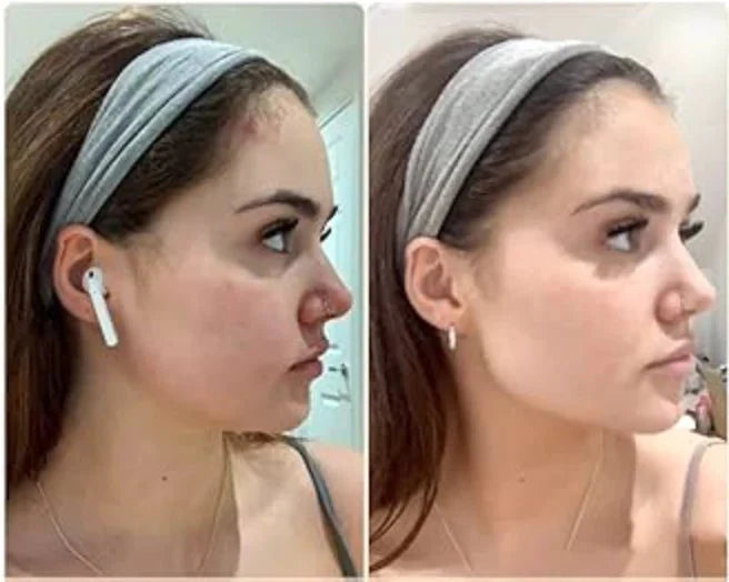 Face Massager